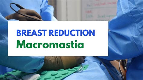 teenage macromastia|Macromastia and Breast Reduction .